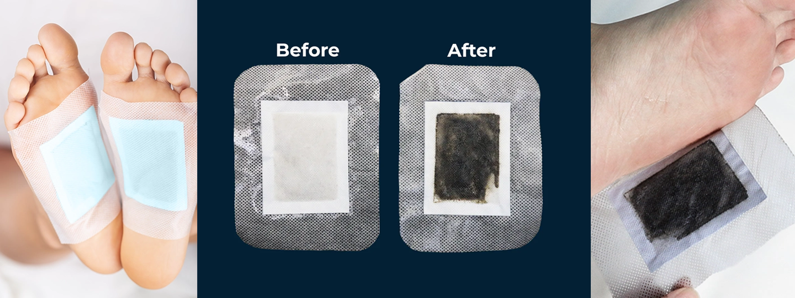 Xitox Foot Pads Review: Do They Really Work?