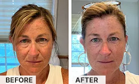 South Beach Collagen Filler Serum Review