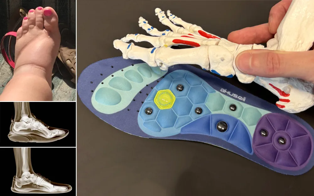 Akusoli Insoles Review: Do They Really Work?
