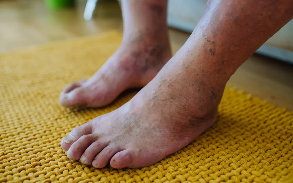Akusoli Insoles Review: Do They Really Work?