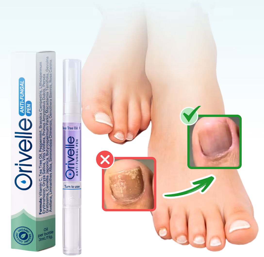 Orivelle Anti-Fungal Pen Review 2026: Does It Work?